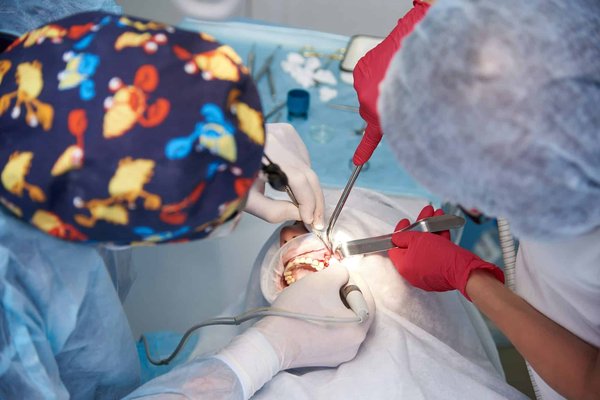 Quels soins après une chirurgie dentaire ?